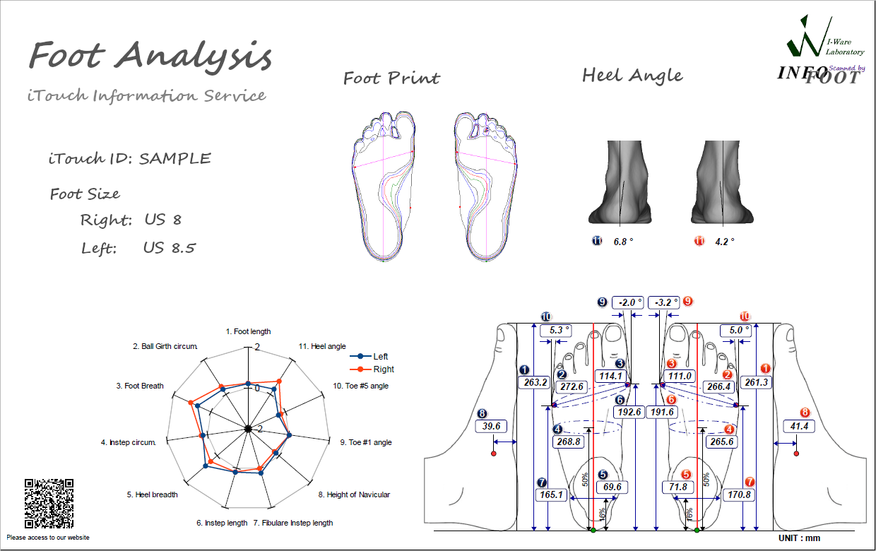 Foot Analysis Sample